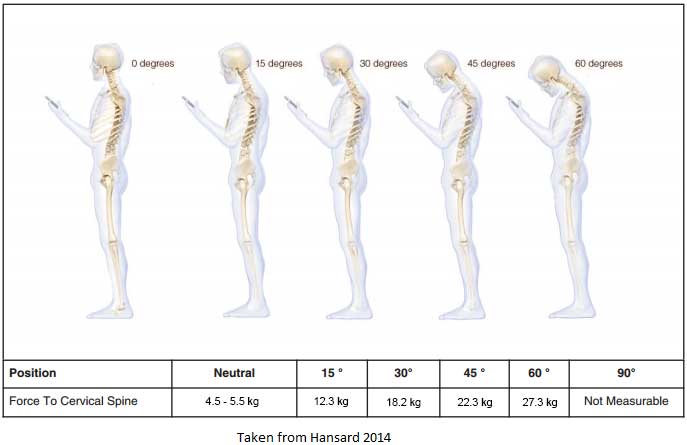 posture-analysis