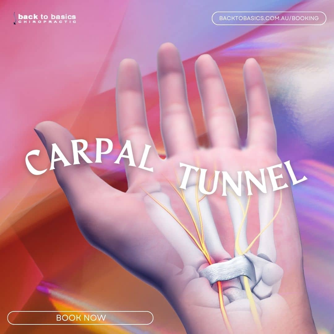 carpal tunnel syndrome